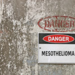 Mesothelioma sign